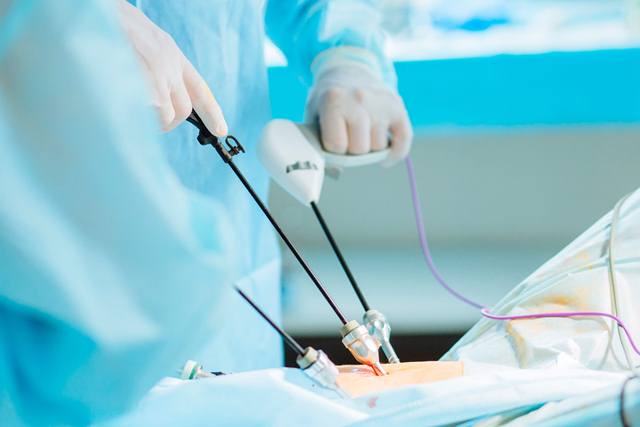 Inovação na Saúde: Prefeitura de Mucuri oferece cirurgias menos invasivas  por laparoscopia no Hospital São José de Itabatã - GOVERNO MUNICIPAL DE  MUCURI